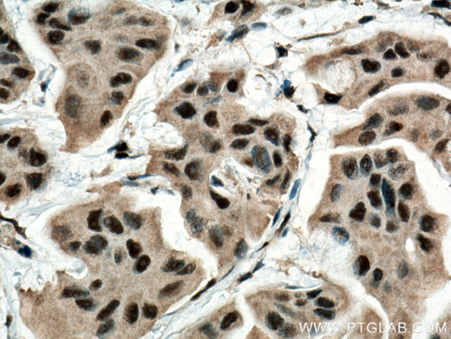 BAT1 Antibody in Immunohistochemistry (Paraffin) (IHC (P))