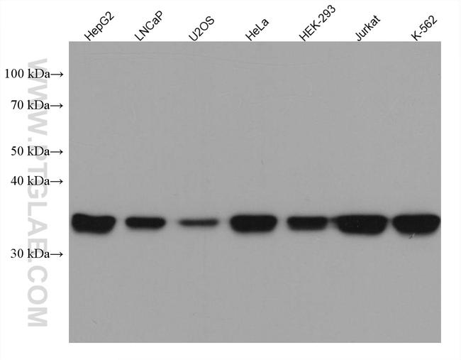 MAT2B Antibody in Western Blot (WB)
