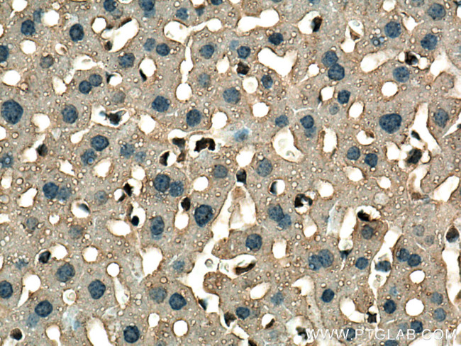 GSTT1 Antibody in Immunohistochemistry (Paraffin) (IHC (P))