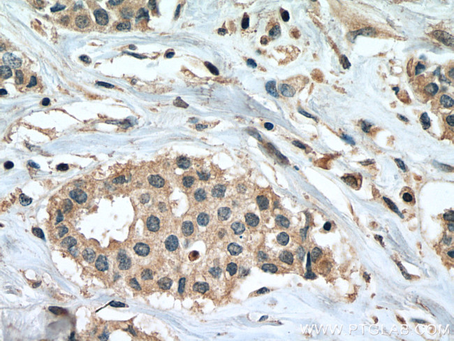 PPM1B Antibody in Immunohistochemistry (Paraffin) (IHC (P))