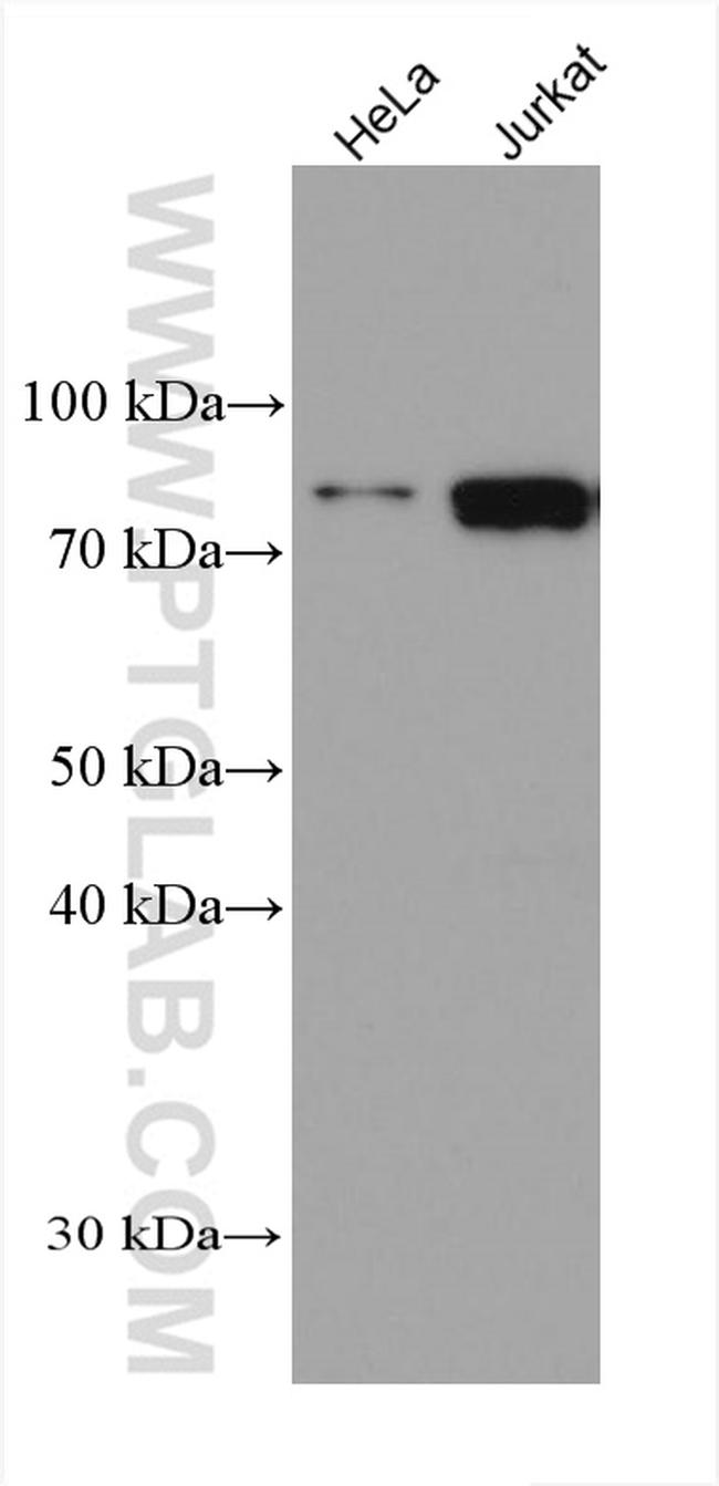 PRMT7 Antibody in Western Blot (WB)