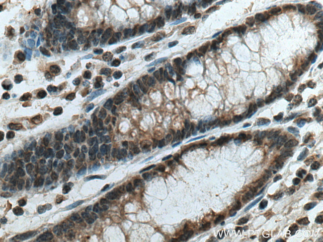 PSMD5 Antibody in Immunohistochemistry (Paraffin) (IHC (P))