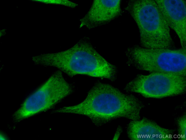RPS12 Antibody in Immunocytochemistry (ICC/IF)