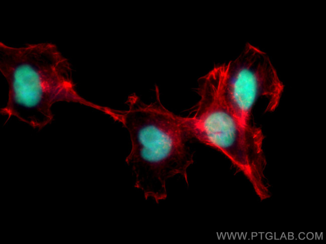 ANP32A Antibody in Immunocytochemistry (ICC/IF)