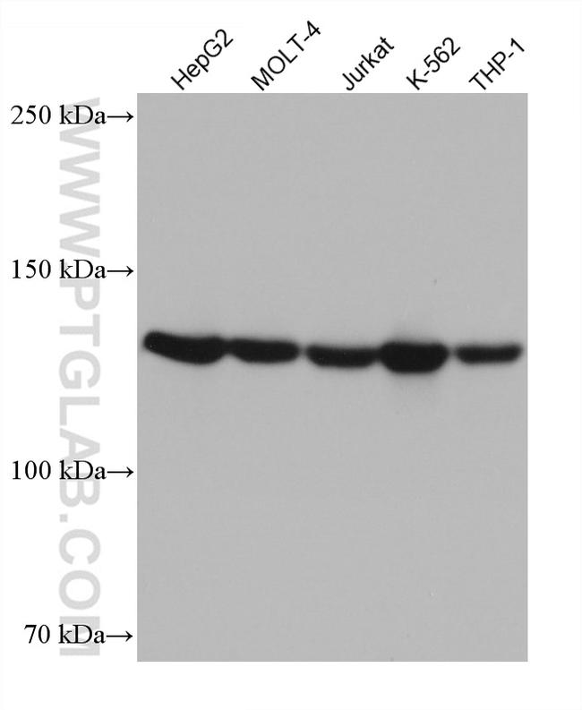 ESYT1 Antibody in Western Blot (WB)