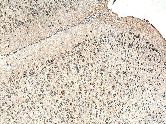 ALPK1 Antibody in Immunohistochemistry (Paraffin) (IHC (P))