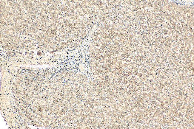 NDUFB8 Antibody in Immunohistochemistry (Paraffin) (IHC (P))