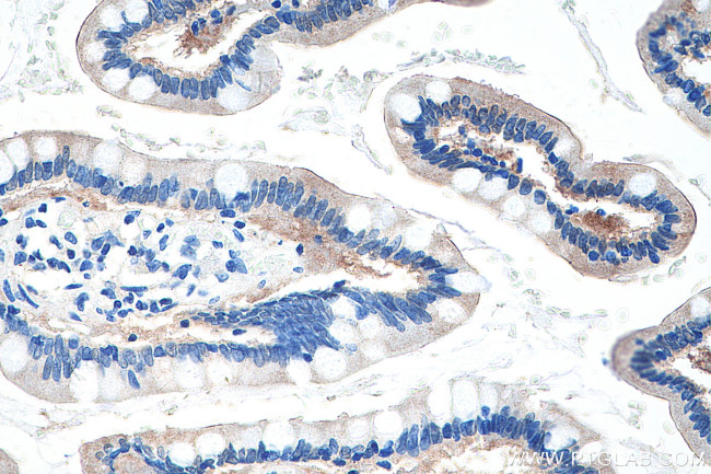 FABP2 Antibody in Immunohistochemistry (Paraffin) (IHC (P))