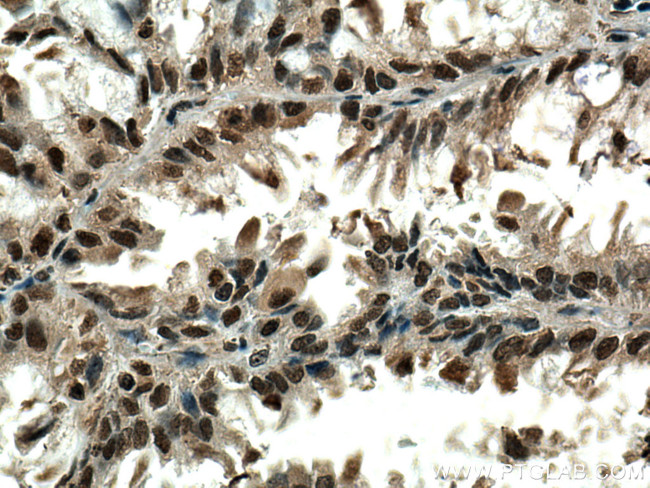 PSMA6 Antibody in Immunohistochemistry (Paraffin) (IHC (P))