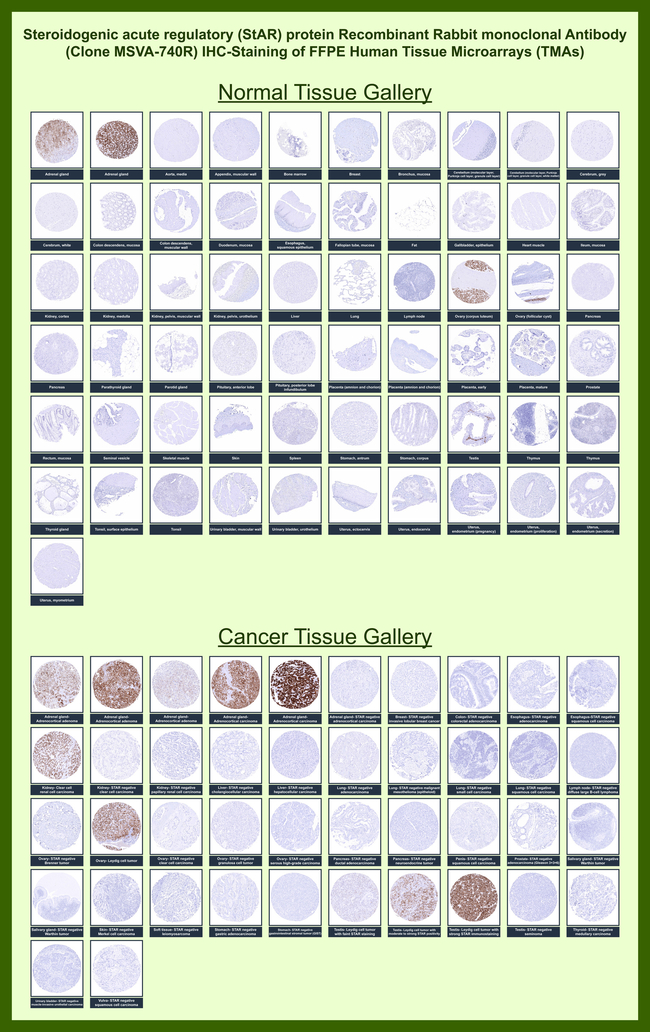 StAR (Steroidogenic Acute Regulator) (Leydig Cell Marker) Antibody in Immunohistochemistry (Paraffin) (IHC (P))