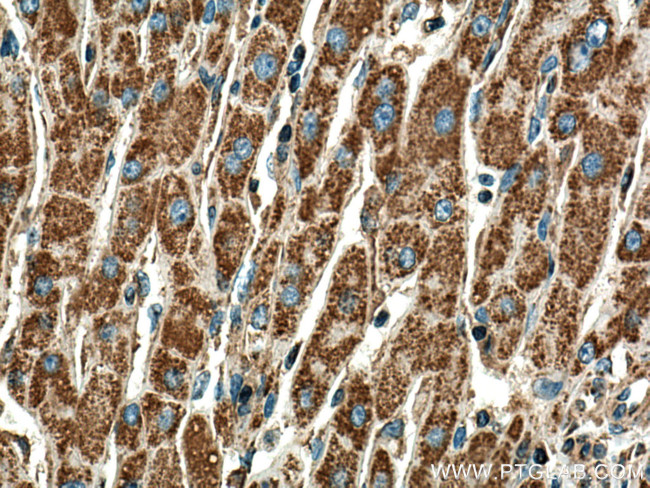 DLD Antibody in Immunohistochemistry (Paraffin) (IHC (P))