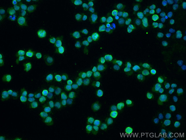 ITK Antibody in Immunocytochemistry (ICC/IF)