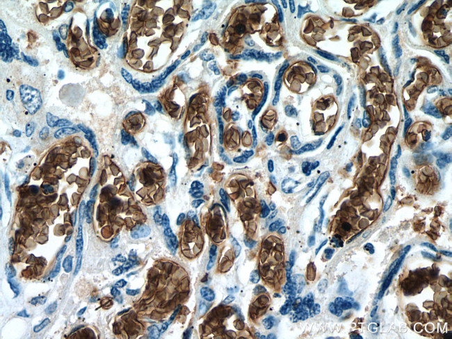 RHAG Antibody in Immunohistochemistry (Paraffin) (IHC (P))