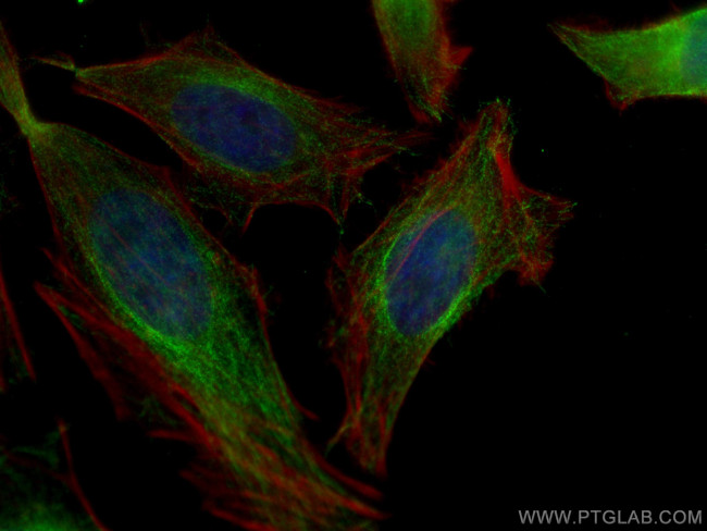 ATG4B Antibody in Immunocytochemistry (ICC/IF)