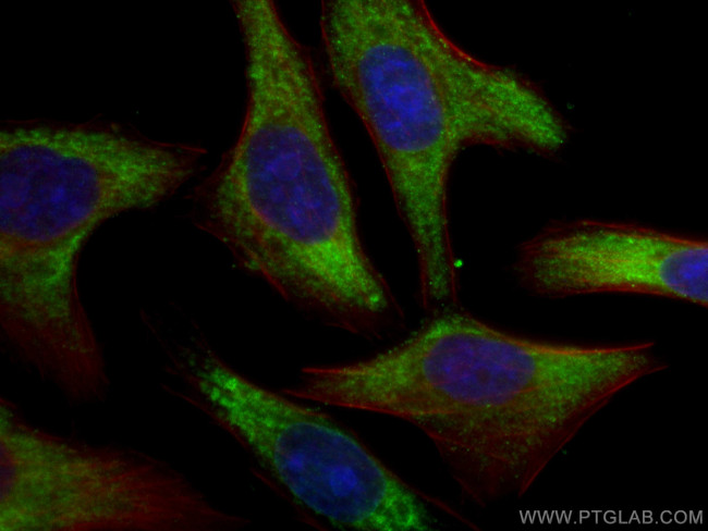 RPL6 Antibody in Immunocytochemistry (ICC/IF)