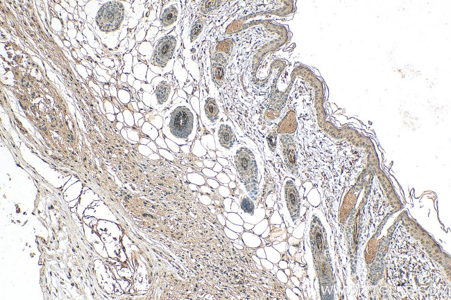 ZNF217 Antibody in Immunohistochemistry (Paraffin) (IHC (P))
