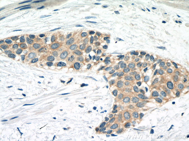 CAPN1 Antibody in Immunohistochemistry (Paraffin) (IHC (P))