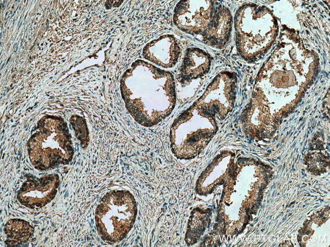 CTPS2 Antibody in Immunohistochemistry (Paraffin) (IHC (P))