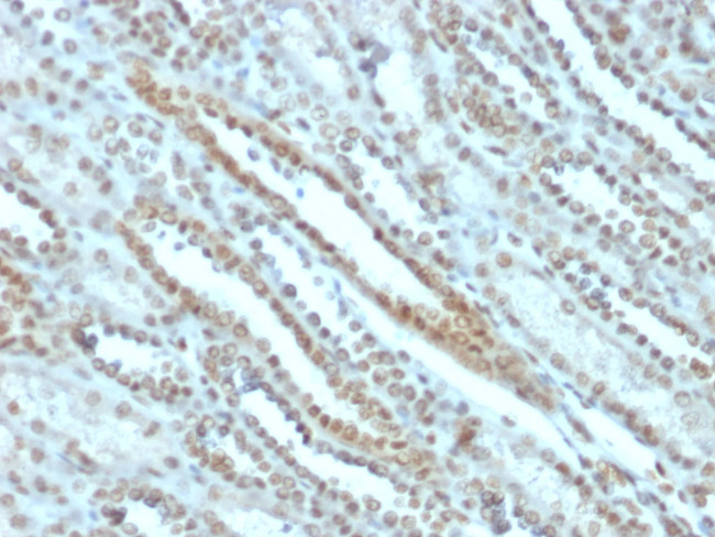 STAT3/Signal Transducer and Activator of Transcription 3 Antibody in Immunohistochemistry (Paraffin) (IHC (P))