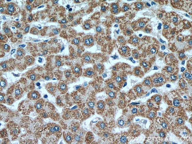ACADM Antibody in Immunohistochemistry (Paraffin) (IHC (P))