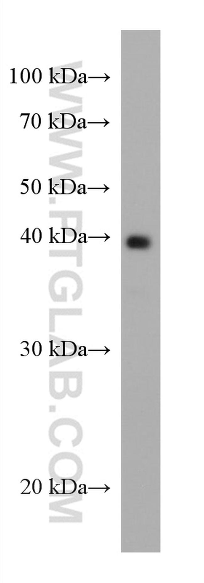 AgBR1 Antibody in Western Blot (WB)