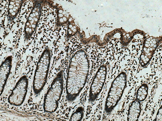 PSMB9 Antibody in Immunohistochemistry (Paraffin) (IHC (P))