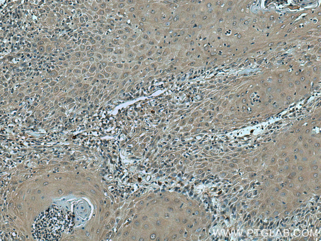 VASH2 Antibody in Immunohistochemistry (Paraffin) (IHC (P))