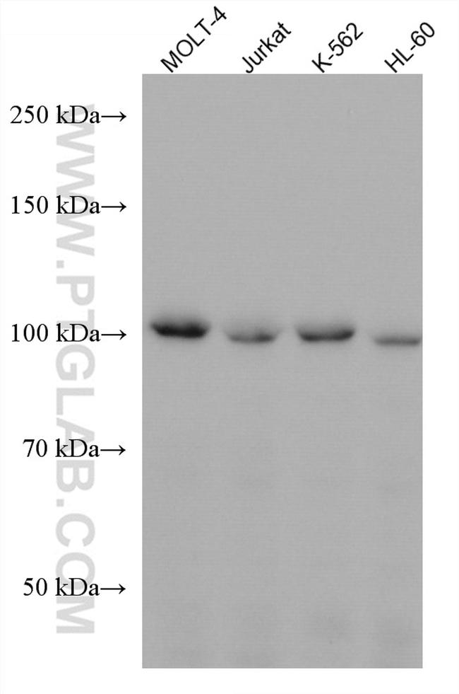 CCDC45 Antibody in Western Blot (WB)