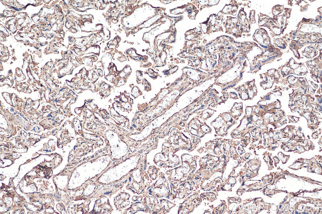 IL-6RB Antibody in Immunohistochemistry (Paraffin) (IHC (P))