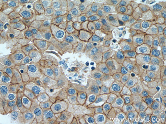 ALCAM Antibody in Immunohistochemistry (Paraffin) (IHC (P))