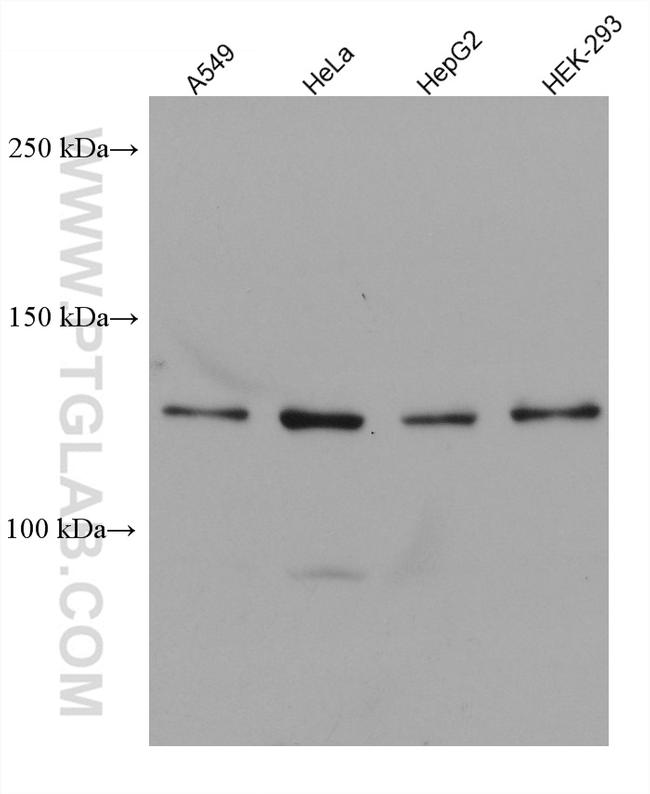 USP25 Antibody in Western Blot (WB)
