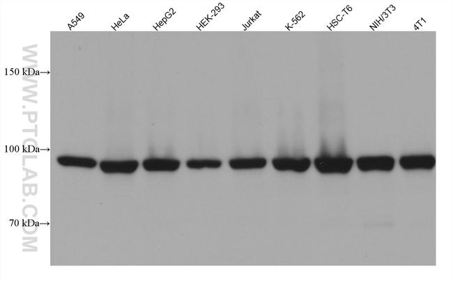 PSMD2 Antibody in Western Blot (WB)