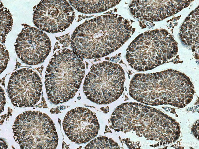 KLHL25 Antibody in Immunohistochemistry (Paraffin) (IHC (P))