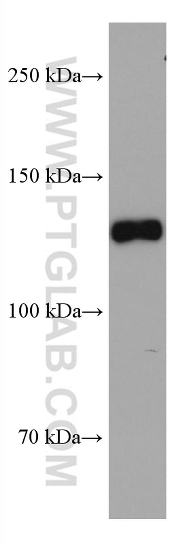 CLIP-115/CLIP2 Antibody in Western Blot (WB)