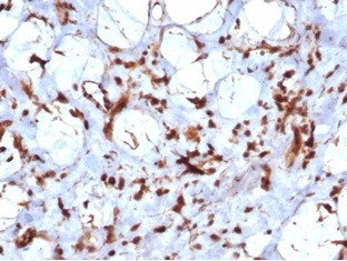 STAT6 (Solitary Fibrous Tumor Marker) Antibody in Immunohistochemistry (Paraffin) (IHC (P))