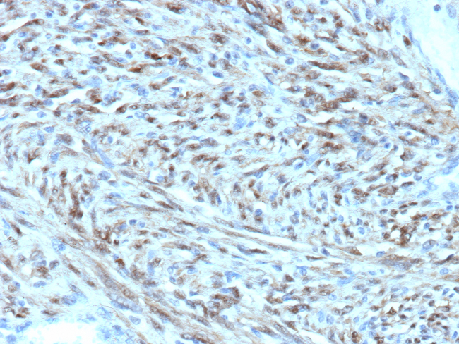 STAT6 (Solitary Fibrous Tumor Marker) Antibody in Immunohistochemistry (Paraffin) (IHC (P))