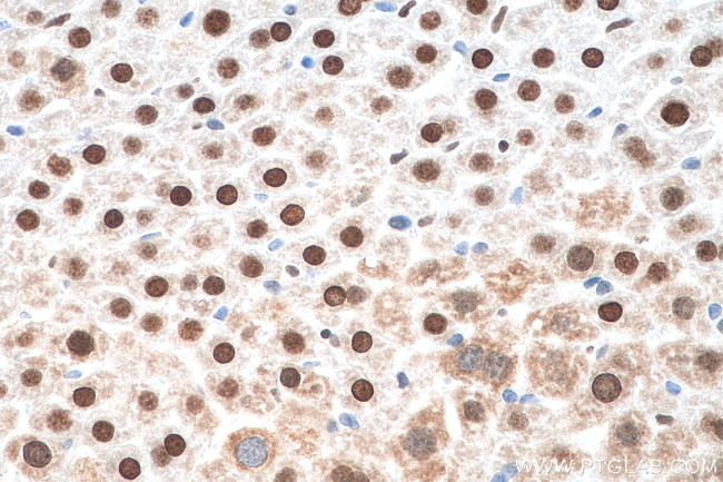 APEX1 Antibody in Immunohistochemistry (Paraffin) (IHC (P))