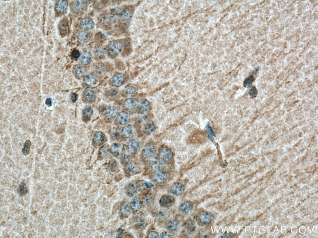 PPP2R2B Antibody in Immunohistochemistry (Paraffin) (IHC (P))