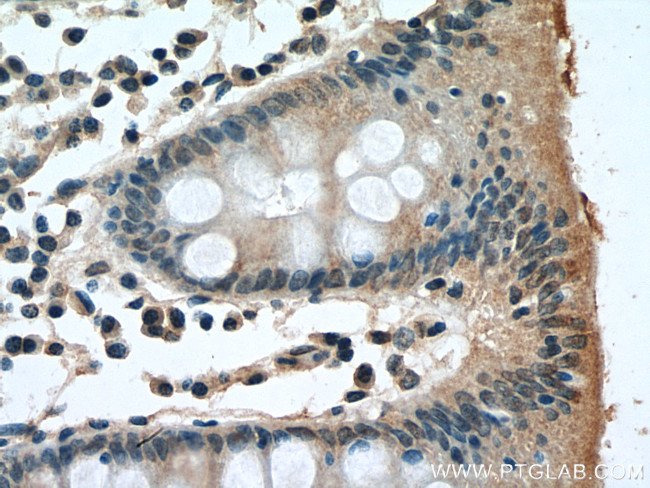 TK1 Antibody in Immunohistochemistry (Paraffin) (IHC (P))