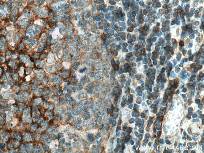 NT5E/CD73 Antibody in Immunohistochemistry (Paraffin) (IHC (P))