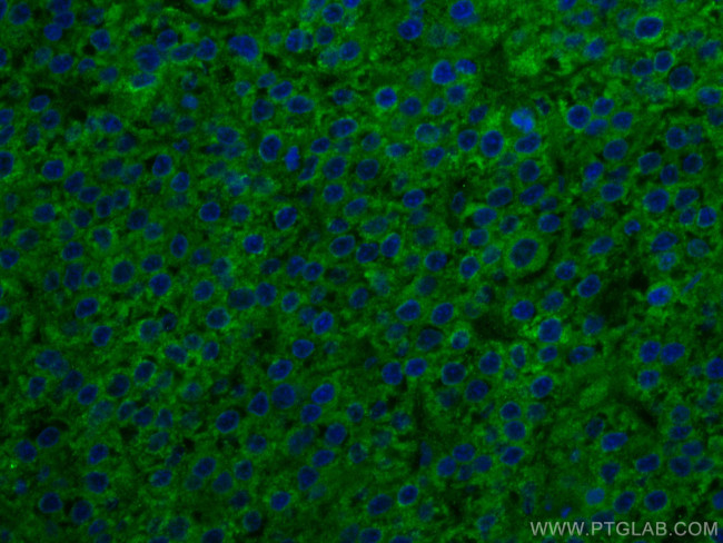 SERBP1 Antibody in Immunohistochemistry (Paraffin) (IHC (P))