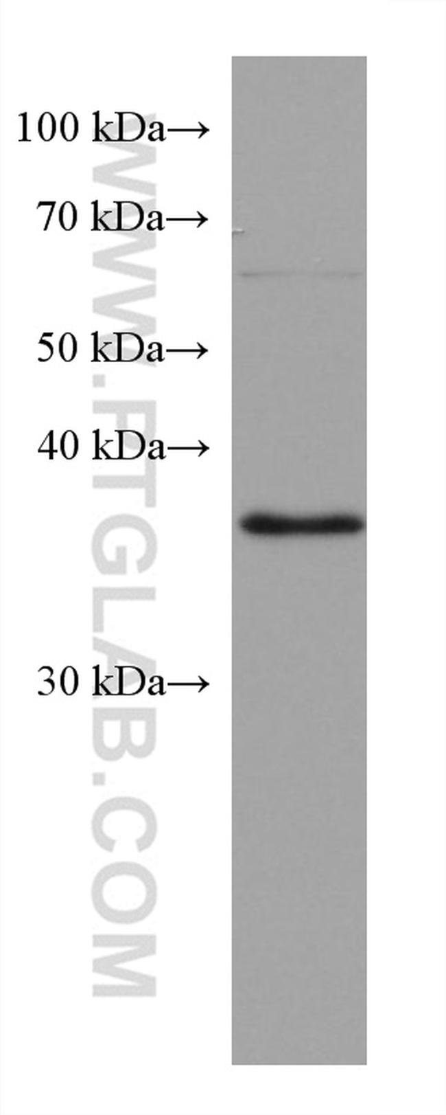 RP2 Antibody in Western Blot (WB)