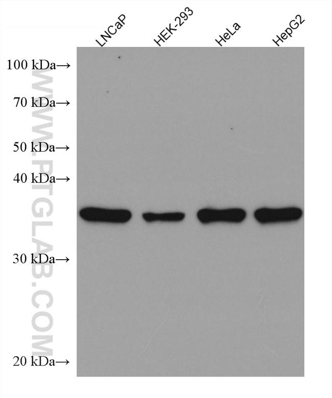 TWF1 Antibody in Western Blot (WB)