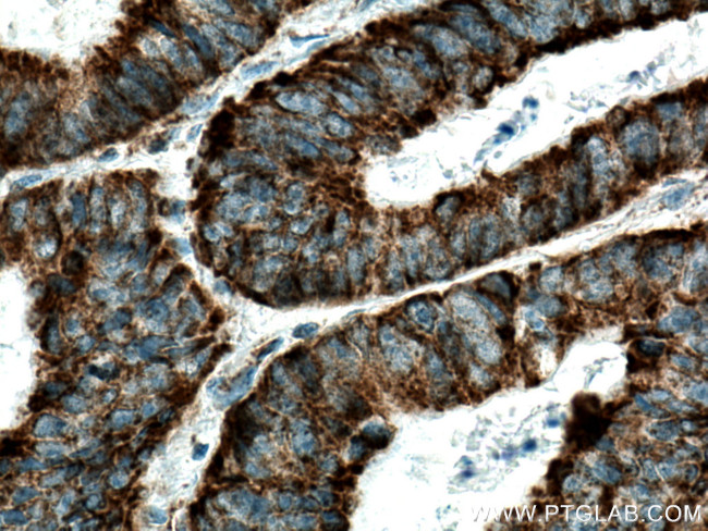 TUFM Antibody in Immunohistochemistry (Paraffin) (IHC (P))