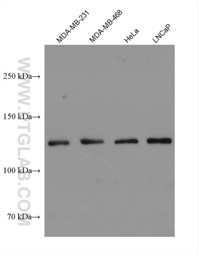 USP28 Antibody in Western Blot (WB)