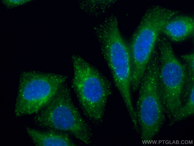 HGS Antibody in Immunocytochemistry (ICC/IF)