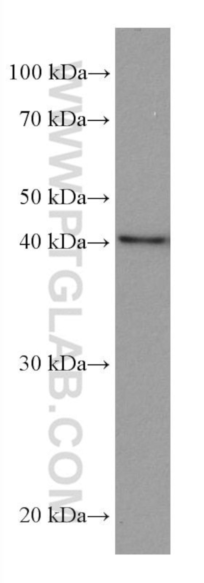 MVK Antibody in Western Blot (WB)