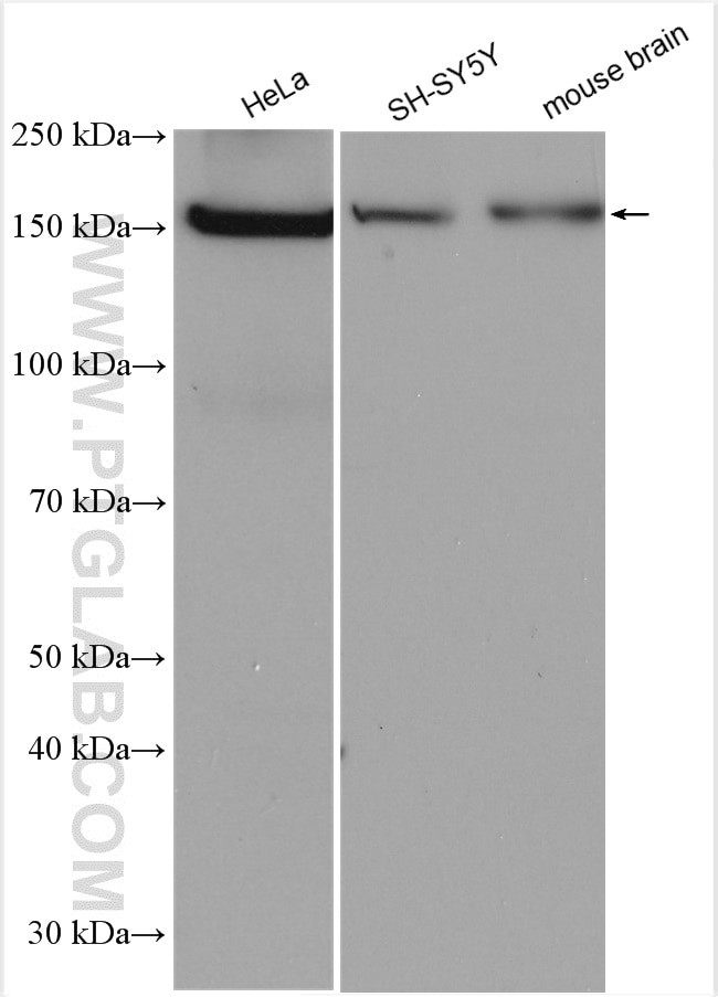 PPARGC1B Antibody in Western Blot (WB)