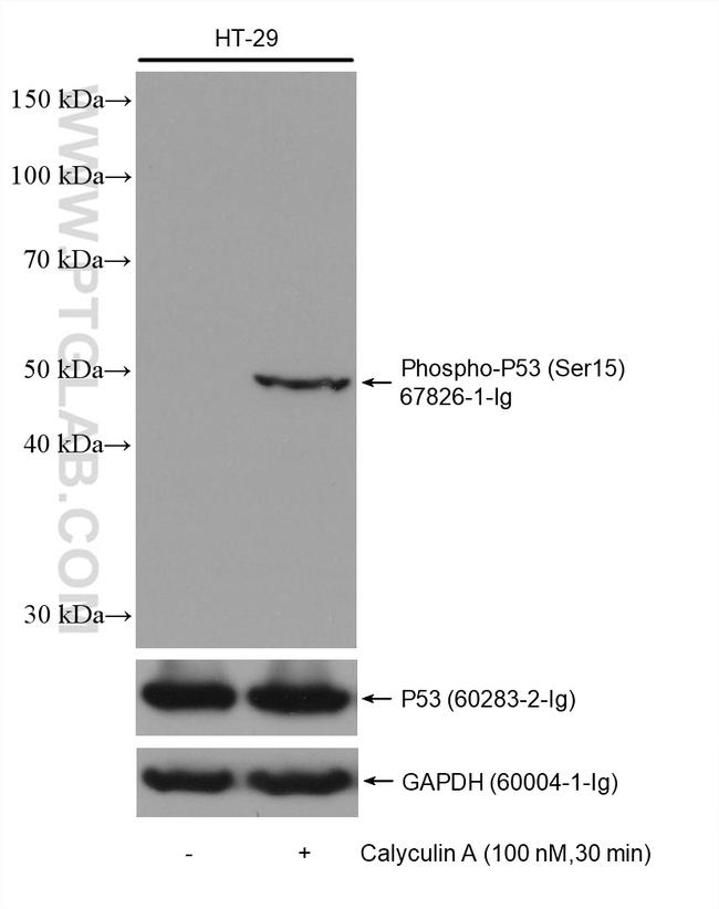 Phospho-P53 (Ser15) Antibody in Western Blot (WB)