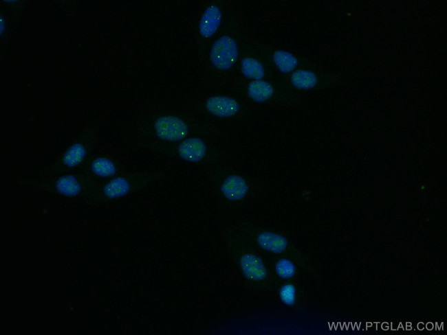 TOE1 Antibody in Immunocytochemistry (ICC/IF)